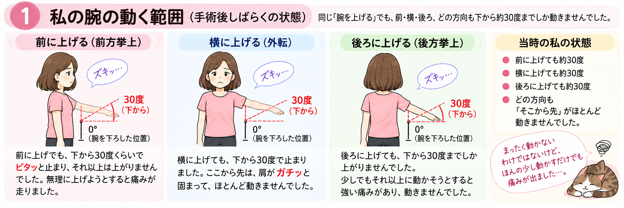 前・横・後ろとも、腕を下ろした位置から約30度までしか上がらなかった当時の状態をまとめたイラスト
